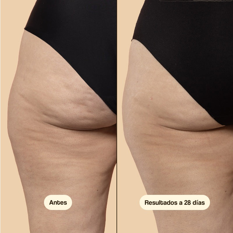 Aceite Anticelulítico y Reductor | Dermiplus